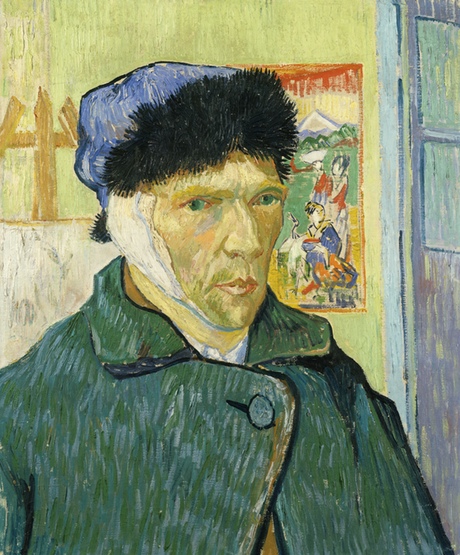 Van_gogh_orelha2